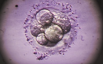 Alabama’s Embryo Personhood Decision Threatens Patients, Medicine and Advances in IVF