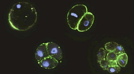 Colonies of single-celled creatures could explain how embryos evolved