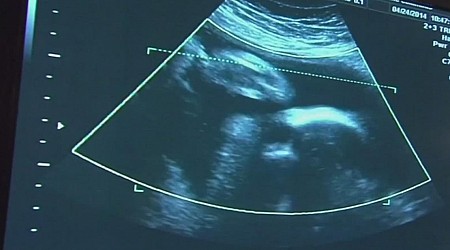 South Carolina's Fetal Heartbeat Law upheld