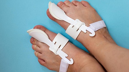 What Are Bunion Correctors, and Can They Cure Bunions? - CNET