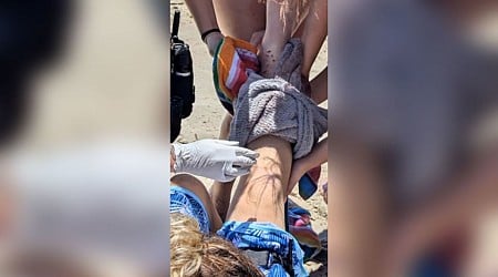 14-year-old is bitten by a shark at a North Carolina beach