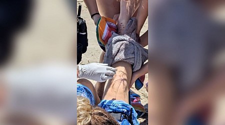 14-year-old is bitten by a shark at a North Carolina beach