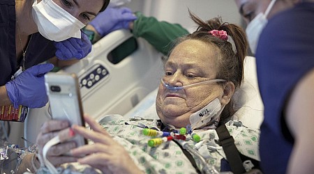 A woman who received a pig kidney transplant plus a heart pump has died
