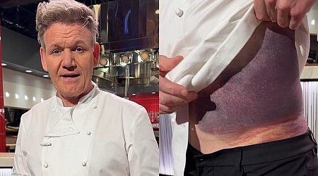 Gordon Ramsay shows off a scary bruise on his torso after getting in a 'really bad' bike accident: 'I'm lucky to be alive'