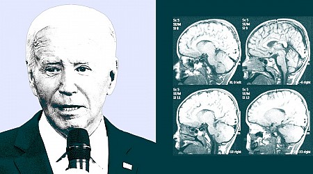 A brain expert explains the cognitive test used to assess a president's mental fitness. It's not easy.