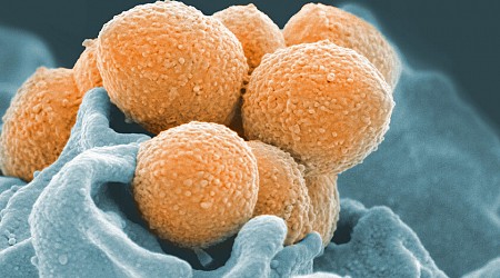 Japón se acerca al millar de casos de shock tóxico estreptocócico, la infección causada por la "bacteria caníbal"