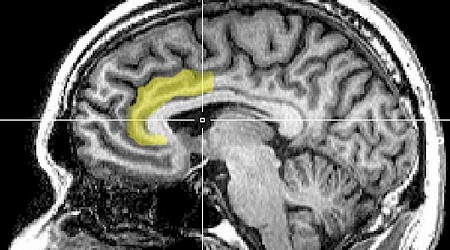 Scientists Identify Brain Circuit That Could Unlock Secrets of Placebo Pain Relief