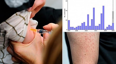 Measles cases in US triple last year’s total