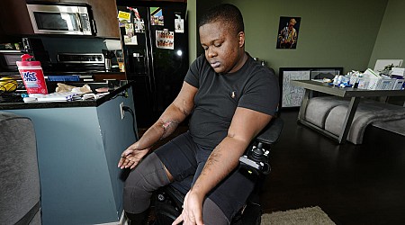 Police recruit who lost both legs in 'barbaric hazing ritual' sues Denver, paramedics and officers