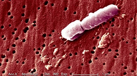A ‘Hypervirulent’ Superbug Is Spreading and Scaring Health Experts