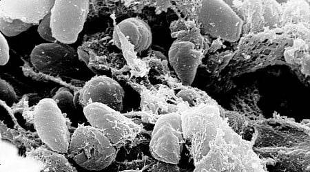 Colorado Plague Case Is a Reminder That the ‘Black Death’ Never Really Went Away