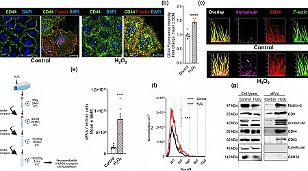 Study links nanoparticles to oxidative stress and neuron death