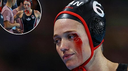 Canadian water polo player's face bloodied in 2024 Olympics