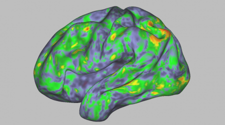 We Can Now See How Psilocybin Changes the Brain