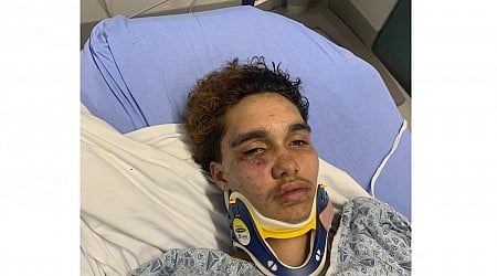 A transgender teen in Massachusetts says other high schoolers beat him at a party