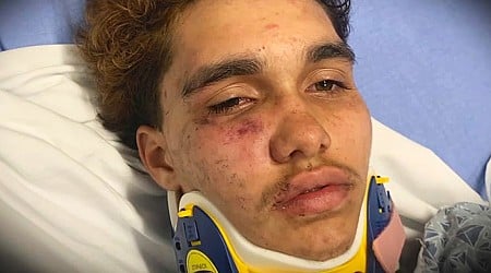 Transgender boy, 16, beaten by large group of teens in Massachusetts