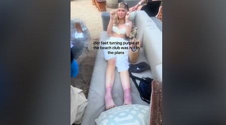 American Woman's Feet Mysteriously Turn Purple on Vacation in Mexico