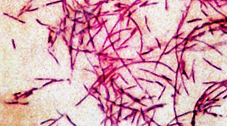 5 diagnosed with Legionnaires' disease in New Hampshire, health officials say