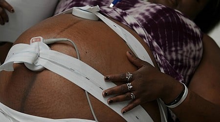 America is trying to fix its maternal mortality crisis with federal, state and local programs