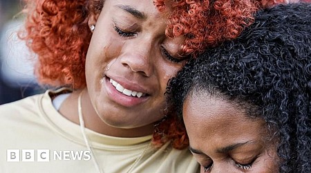 After a brain bleed, a Georgia hospital temporarily removed part of a man’s skull. Employees lost the bone, lawsuit says