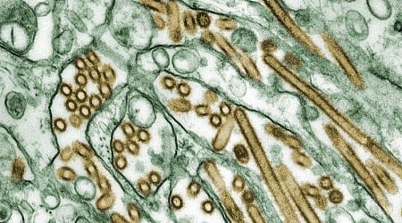 Mysterious bird flu case in Missouri was similar to strain circulating in cattle, CDC says