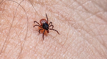 Connecticut has first human case of rare tick-borne disease