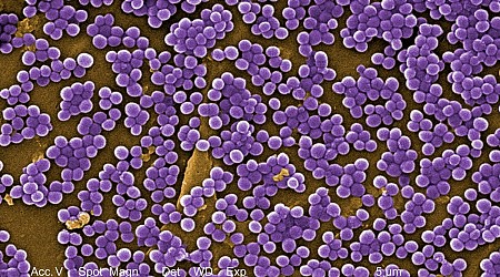 Superbugs Will Kill Nearly 40 Million People Over the Next 25 Years, Scientists Warn