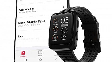 Per giuria smartwatch di Masimo hanno violato brevetti ma è una vittoria di Pirro per Apple