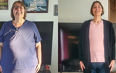 I lost half my weight in 3 years. I have body dysmorphia from all the loose skin I have.