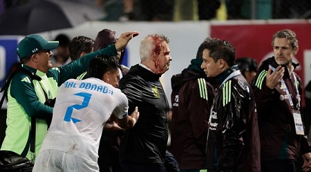 Mexico soccer manager Javier Aguirre struck by can thrown onto the pitch from stands, left with bloodied head