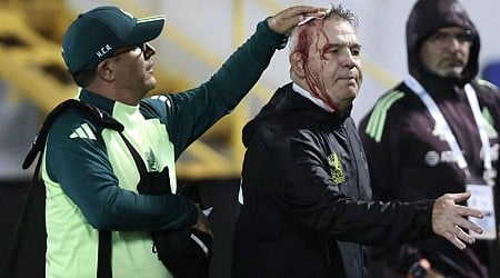 Mexico soccer coach Javier Aguirre injured after being hit in head by apparent beer can that was thrown from the stands