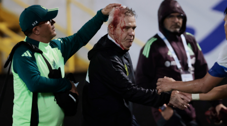 Mexico head coach Javier Aguirre bloodied by thrown can following loss to Honduras in Concacaf Nations League