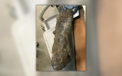 Photo Authentically Shows Dinosaur Limb with 'Remarkable' Features