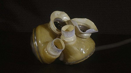 Today in History: First permanent artificial heart implanted