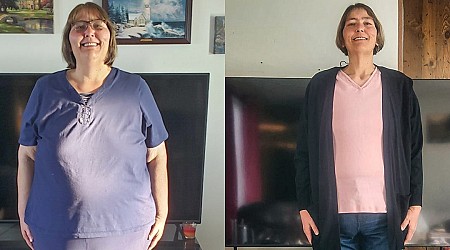 I lost half my weight in 3 years. I have body dysmorphia from all the loose skin I have.