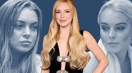 Lindsay Lohan’s face might be part of a few trends in plastic surgery.