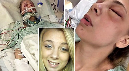 Ex-meth user who gouged her own eyeballs out while high says she is ‘happier’ years after nightmarish episode