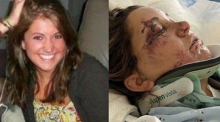 Southern Colorado woman recovering from brutal attack in Huntington Beach