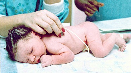 Today in History: First American ‘test-tube’ baby born