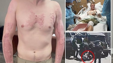 Man suffers burns after cops 'cooked' his skin on hot asphalt: complaint