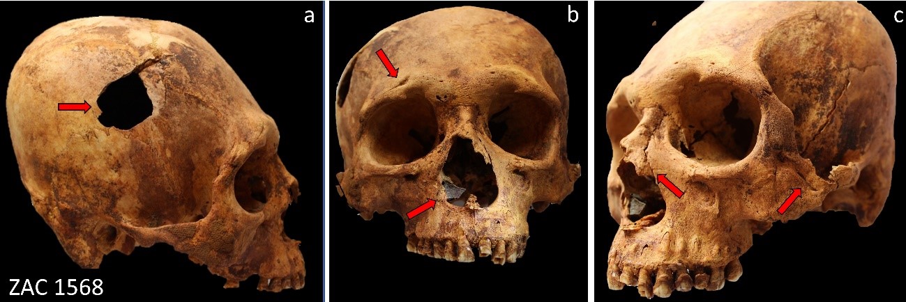 Exumação de 67 esqueletos traz sinais de massacre no Peru há 2.500 anos