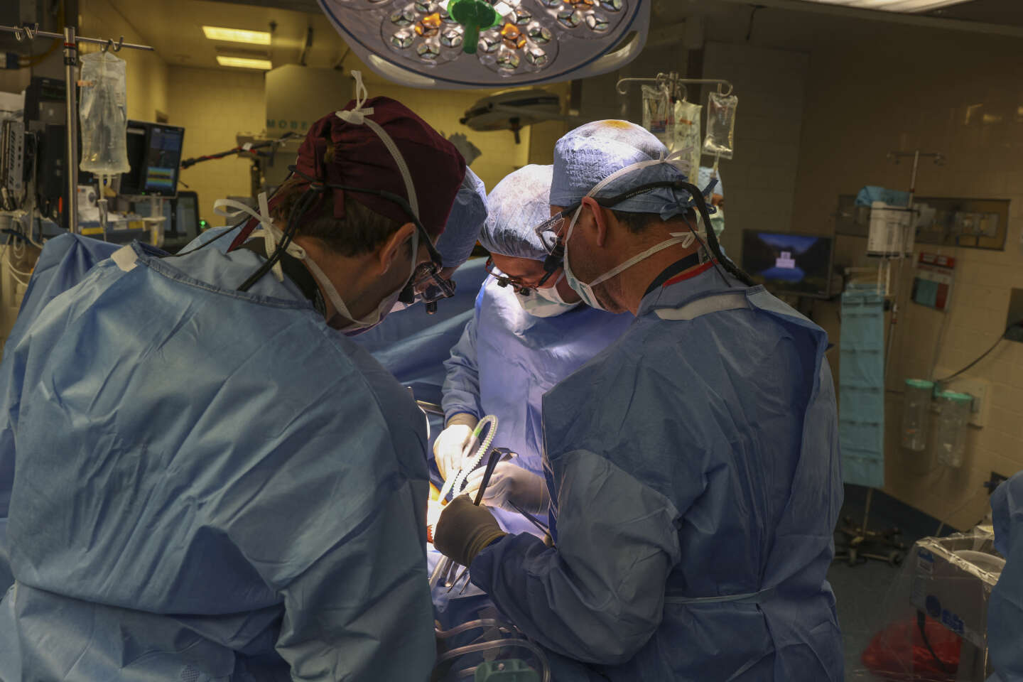 Aux Etats-Unis, un rein de porc a été transplanté pour la première fois sur un patient vivant