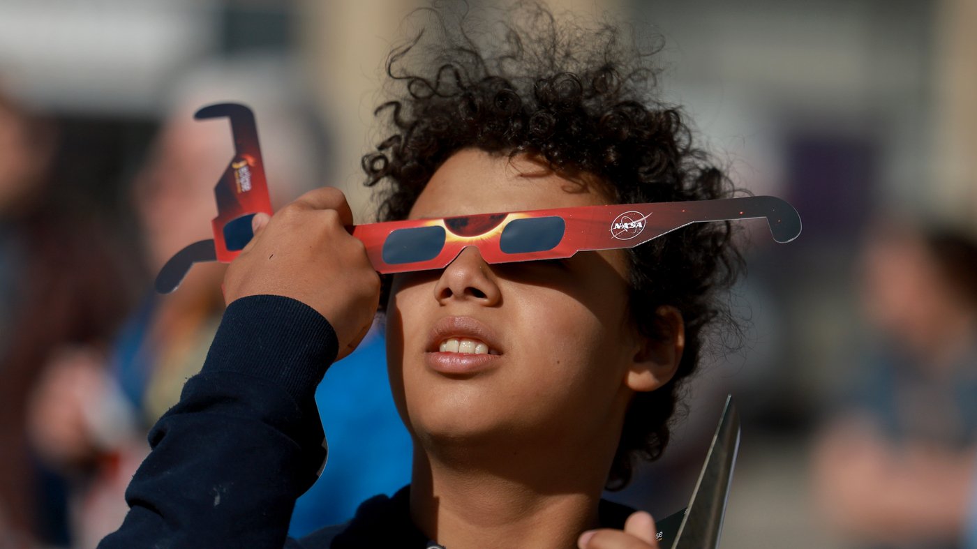 Worried that watching the eclipse damaged your eyes? Don't panic