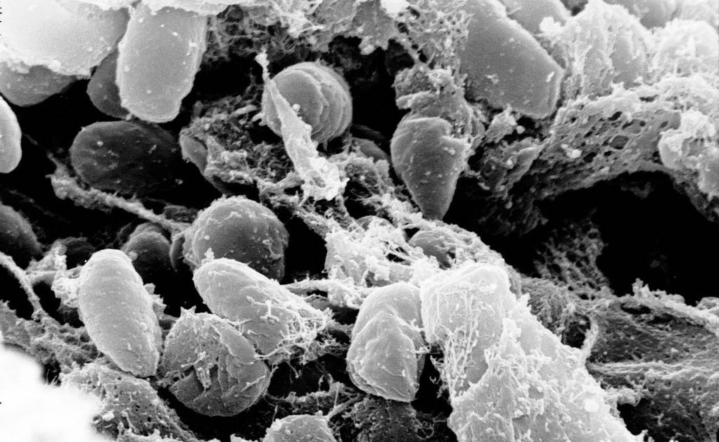 Colorado Plague Case Is a Reminder That the ‘Black Death’ Never Really Went Away
