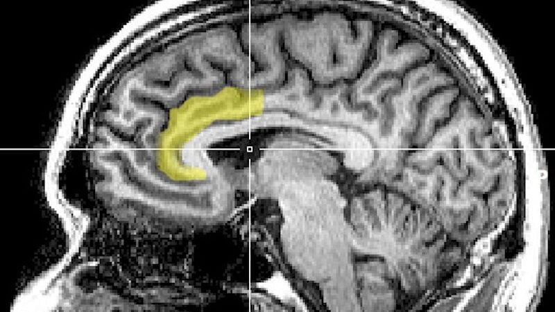 Scientists Identify Brain Circuit That Could Unlock Secrets of Placebo Pain Relief