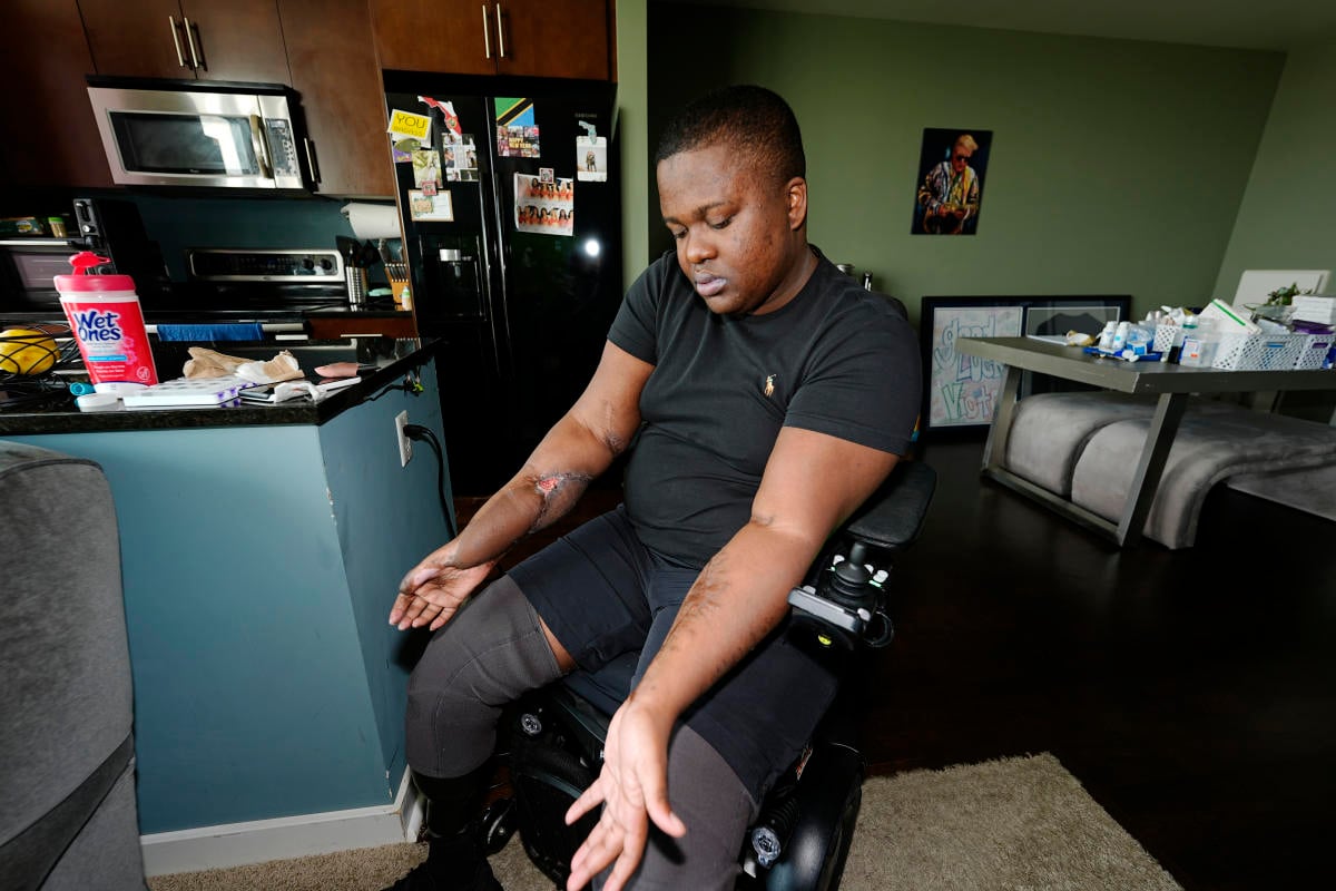 Police recruit who lost both legs in 'barbaric hazing ritual' sues Denver, paramedics and officers