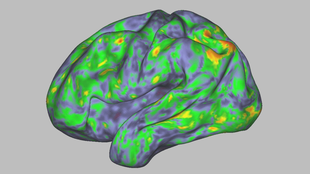 We Can Now See How Psilocybin Changes the Brain