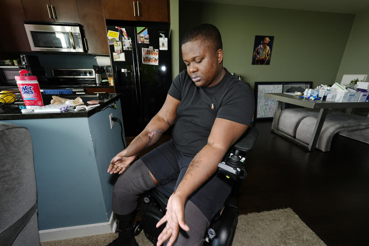 Police recruit who lost both legs in 'barbaric hazing ritual' sues Denver, paramedics and officers