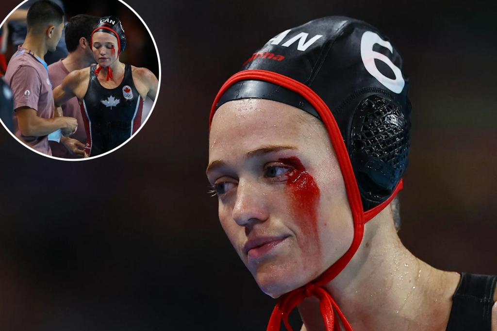 Canadian water polo player's face bloodied in 2024 Olympics