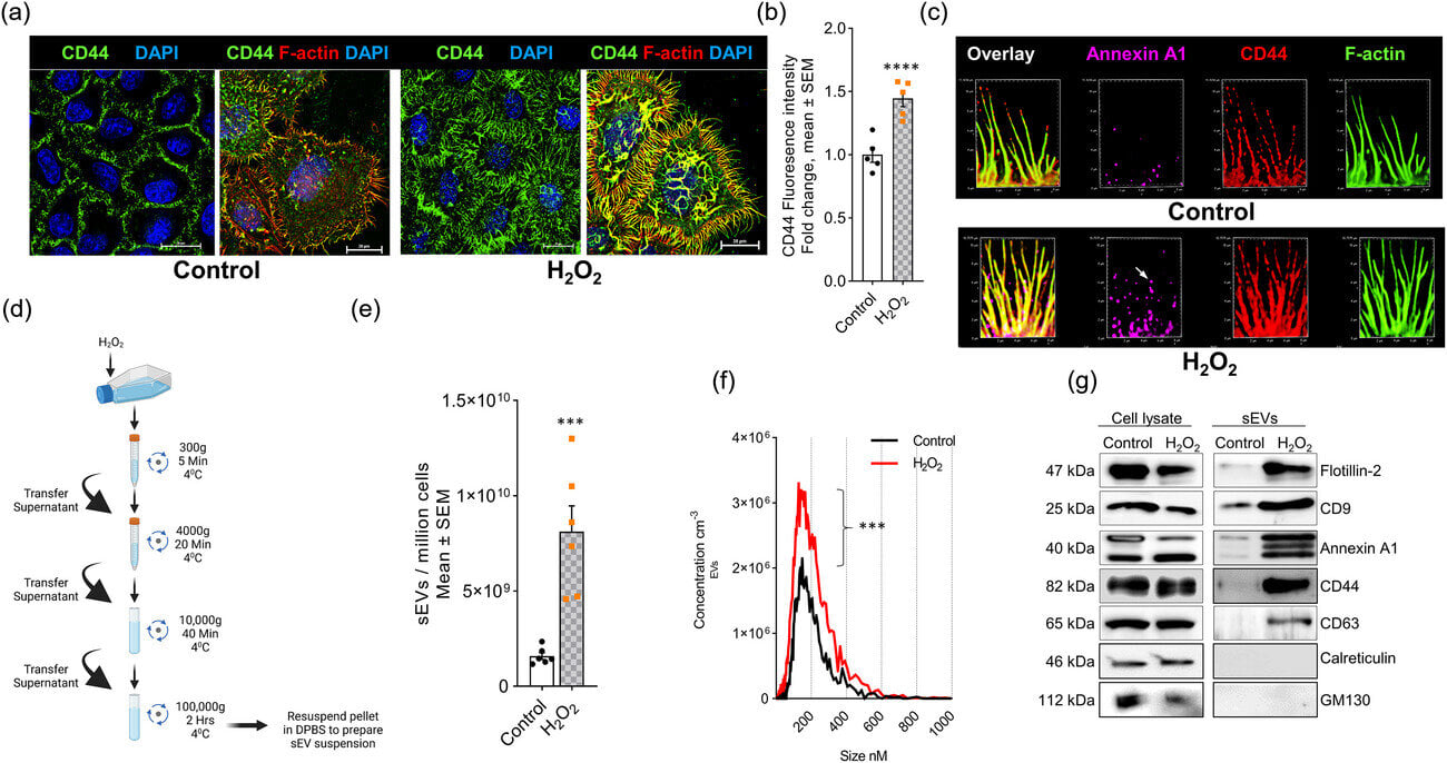 Study links nanoparticles to oxidative stress and neuron death